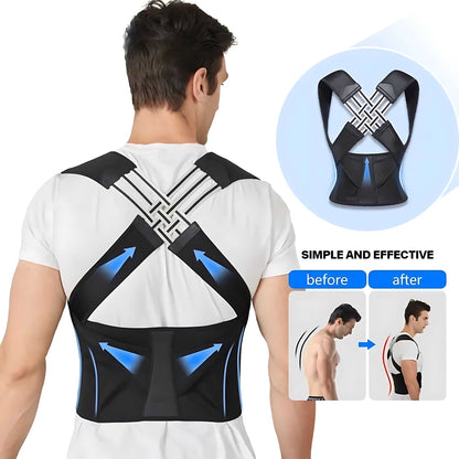 BackGuardian™ - Smart Posture Corrector